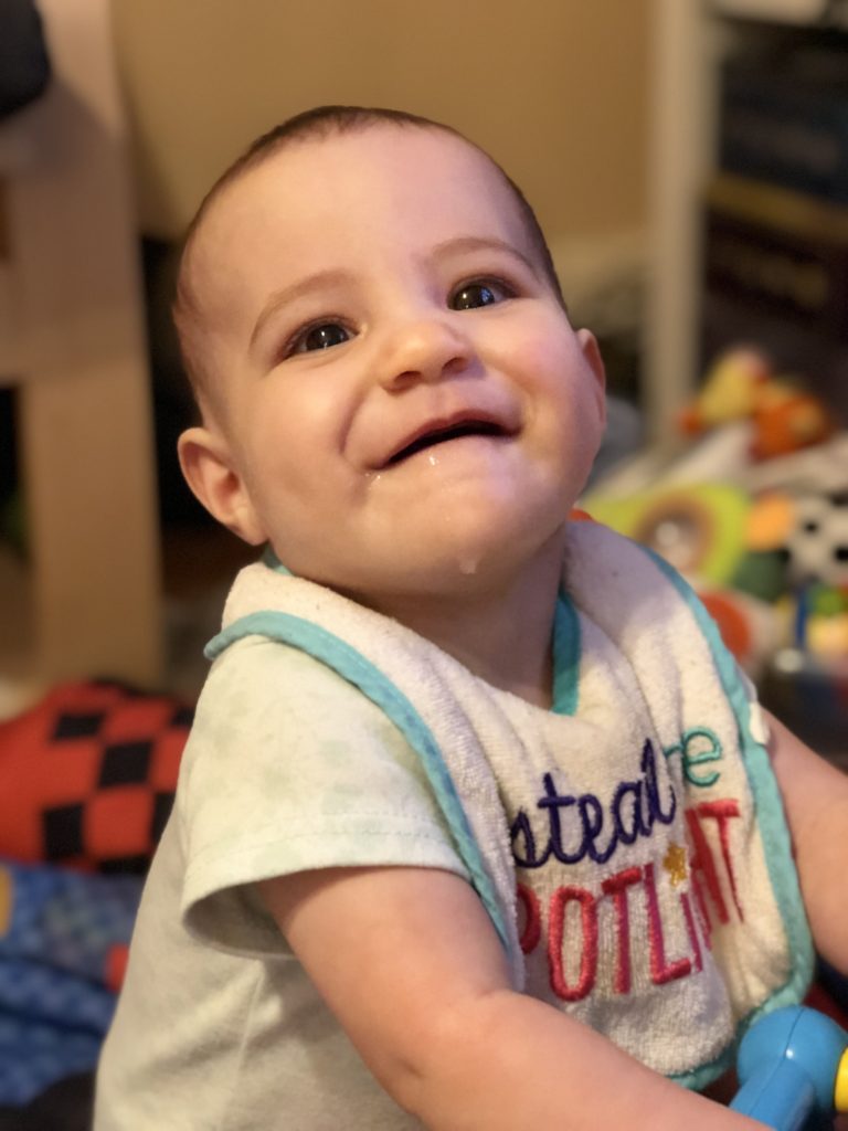 A smiling cleft palate baby with drool on her chin, wearing a cloth bib.