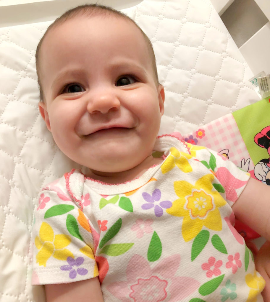 A smiling cleft palate baby wearing a floral bodysuit, laying on a changing pad.