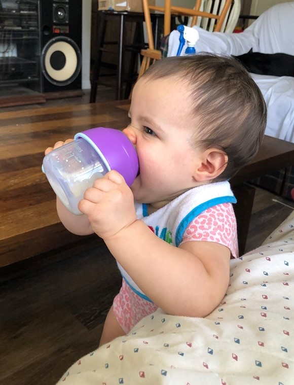 A baby with cleft palate drinking from a sippy cup