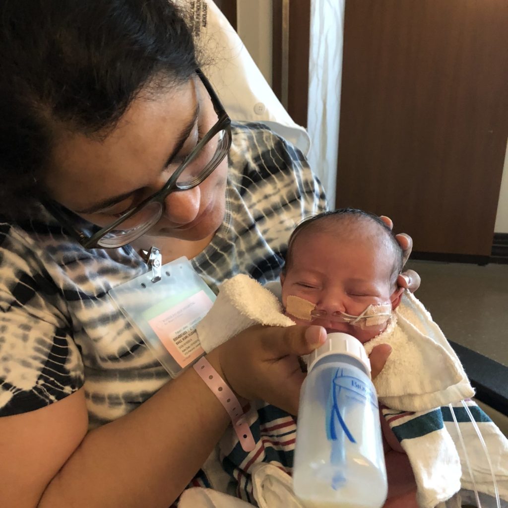 Mother holding baby with Pierre Robin Sequence and feeding baby milk with special bottle