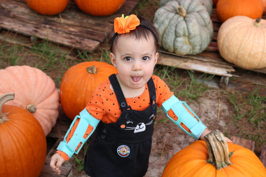 A baby standing in a pumpkin patch wearing arm restraints after palate repair
