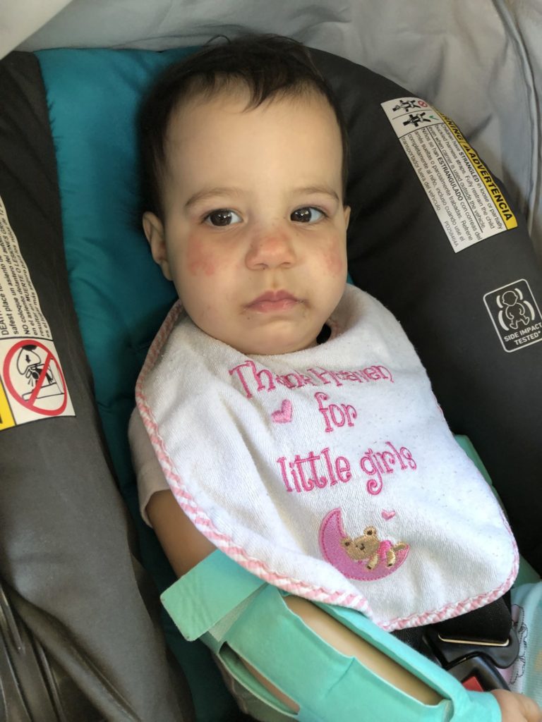 A baby sitting in a car seat wearing a bib and arm restraints after palate repair surgery