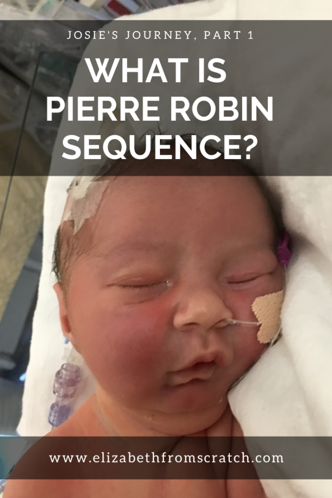 pierre robin sequence in utero
